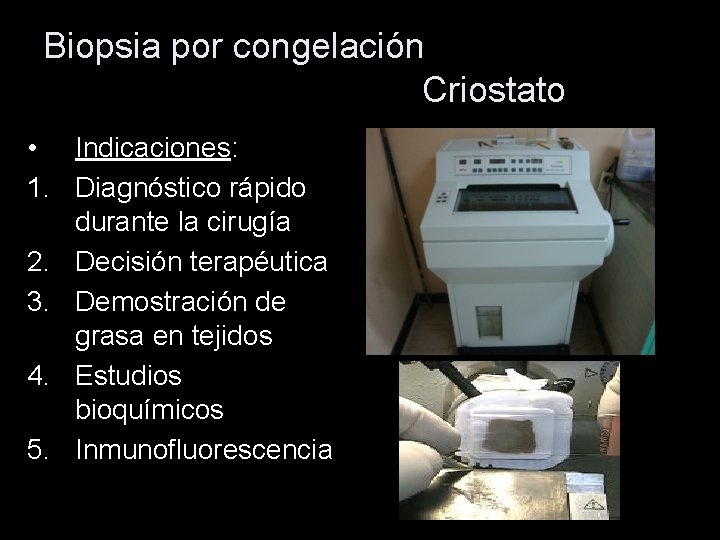 Biopsia por congelación Criostato • Indicaciones: 1. Diagnóstico rápido durante la cirugía 2. Decisión