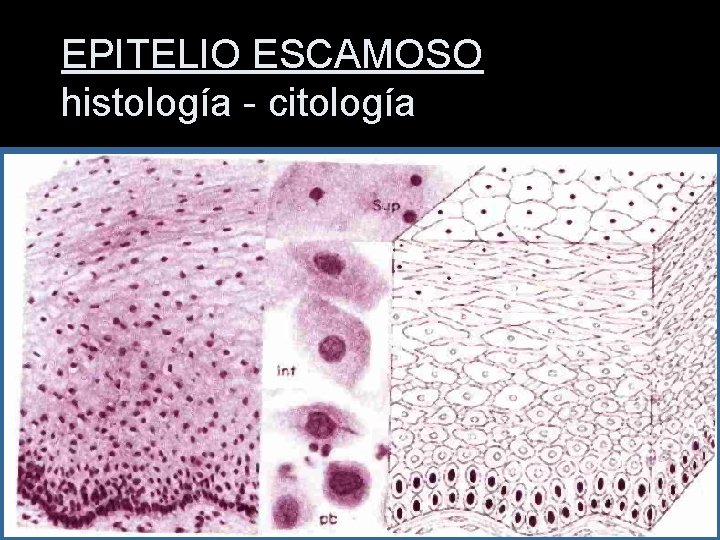 EPITELIO ESCAMOSO histología - citología 