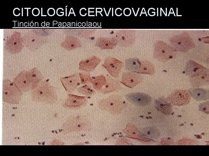 CITOLOGÍA CERVICOVAGINAL Tinción de Papanicolaou 