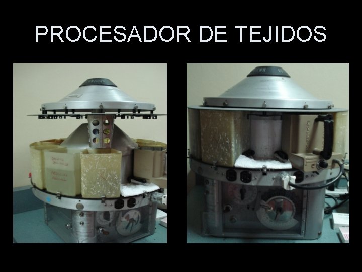 PROCESADOR DE TEJIDOS 