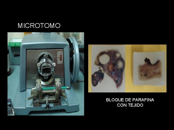 MICROTOMO BLOQUE DE PARAFINA CON TEJIDO 
