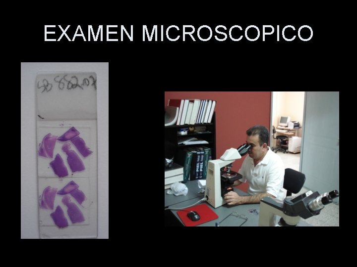 EXAMEN MICROSCOPICO 