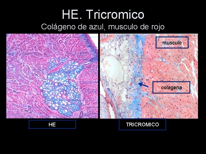 HE. Tricromico Colágeno de azul, musculo de rojo musculo colagena HE TRICROMICO 