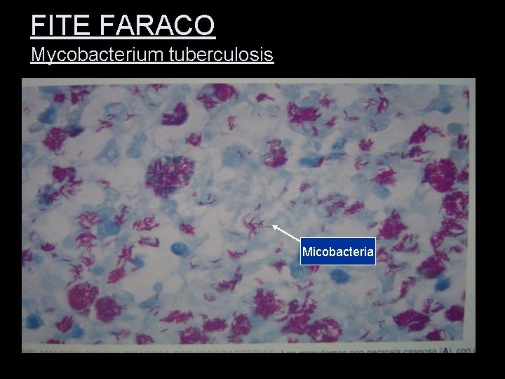 FITE FARACO Mycobacterium tuberculosis Micobacteria 