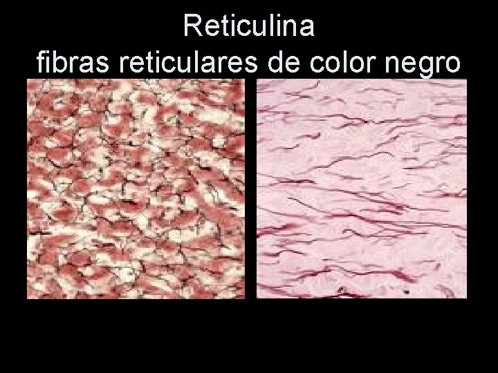 Reticulina fibras reticulares de color negro 