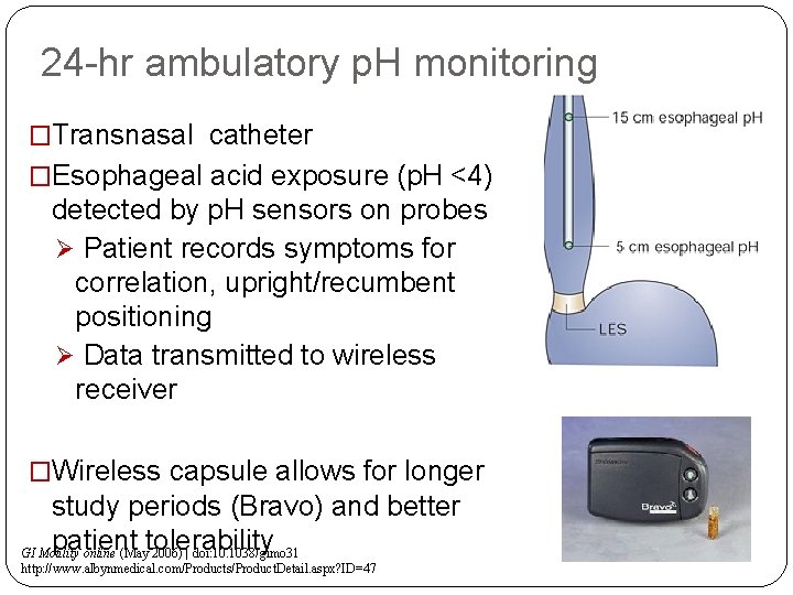24 -hr ambulatory p. H monitoring �Transnasal catheter �Esophageal acid exposure (p. H <4)