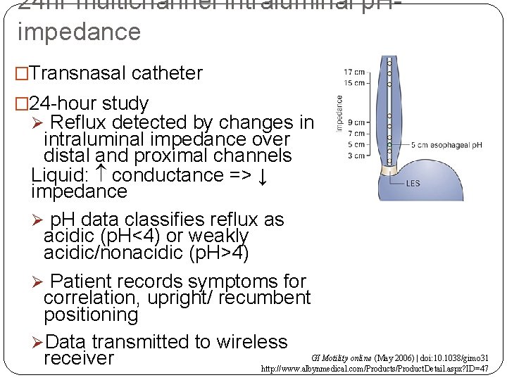 24 hr multichannel intraluminal p. Himpedance �Transnasal catheter � 24 -hour study Ø Reflux