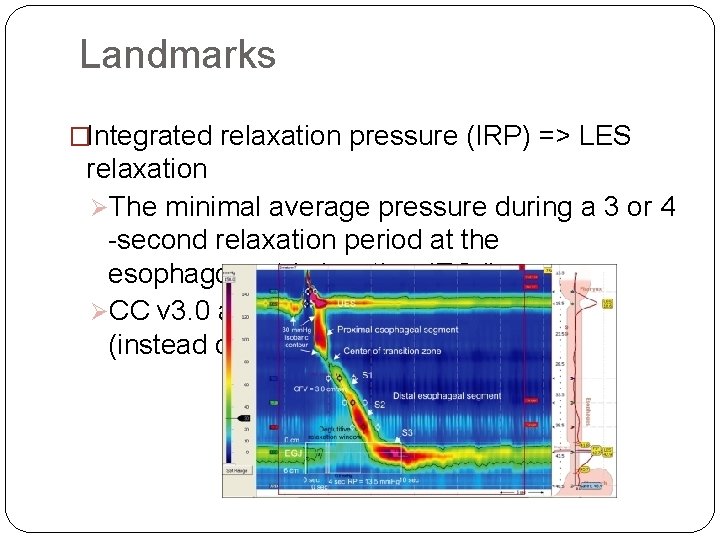 Landmarks �Integrated relaxation pressure (IRP) => LES relaxation ØThe minimal average pressure during a