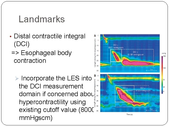 Landmarks • Distal contractile integral (DCI) => Esophageal body contraction Ø Incorporate the LES