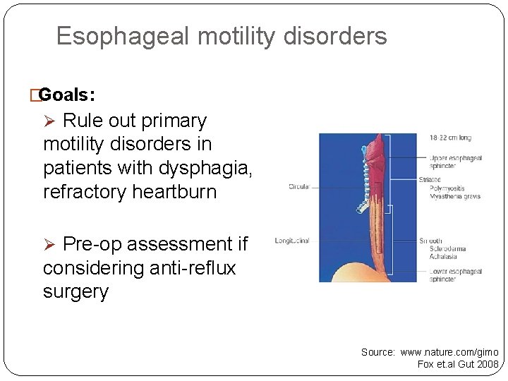 Esophageal motility disorders �Goals: Ø Rule out primary motility disorders in patients with dysphagia,