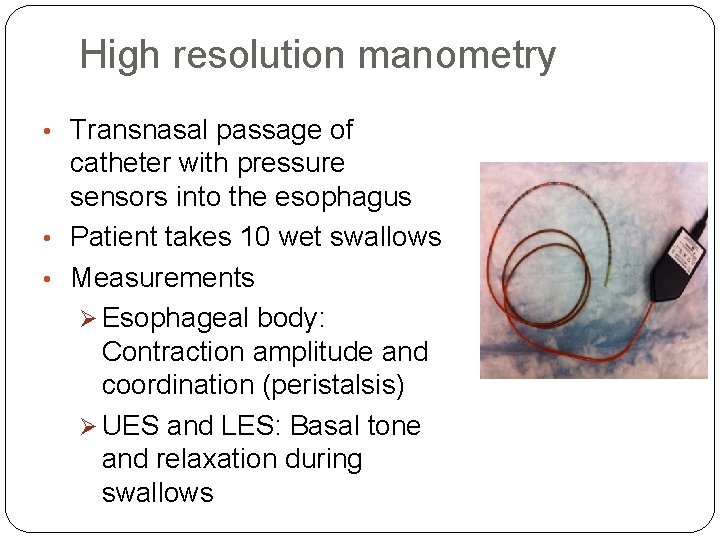 High resolution manometry • Transnasal passage of catheter with pressure sensors into the esophagus