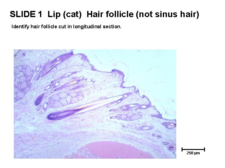 SLIDE 1 Lip (cat) Hair follicle (not sinus hair) Identify hair follicle cut in SLIDE 1 Lip (cat) Hair follicle (not sinus hair) Identify hair follicle cut in