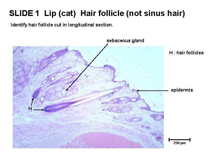 SLIDE 1 Lip (cat) Hair follicle (not sinus hair) Identify hair follicle cut in SLIDE 1 Lip (cat) Hair follicle (not sinus hair) Identify hair follicle cut in