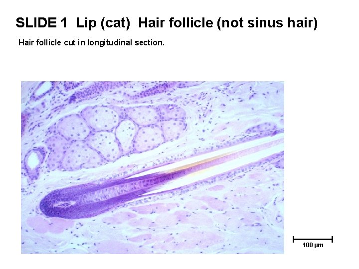 SLIDE 1 Lip (cat) Hair follicle (not sinus hair) Hair follicle cut in longitudinal SLIDE 1 Lip (cat) Hair follicle (not sinus hair) Hair follicle cut in longitudinal