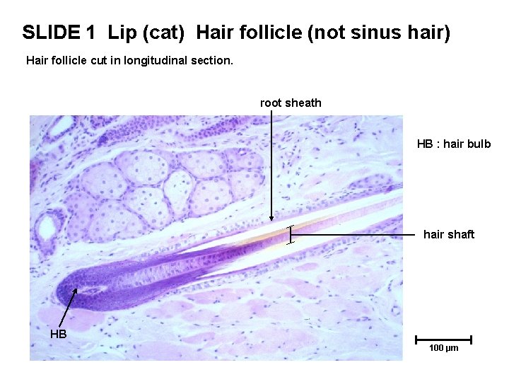 SLIDE 1 Lip (cat) Hair follicle (not sinus hair) Hair follicle cut in longitudinal SLIDE 1 Lip (cat) Hair follicle (not sinus hair) Hair follicle cut in longitudinal