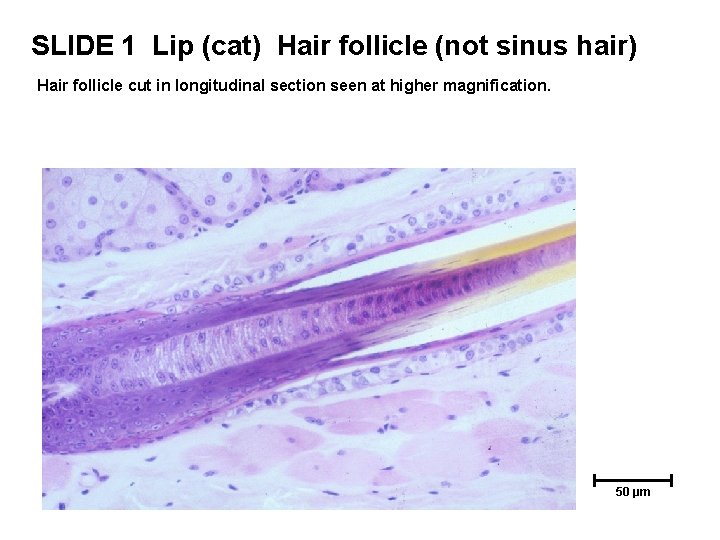 SLIDE 1 Lip (cat) Hair follicle (not sinus hair) Hair follicle cut in longitudinal SLIDE 1 Lip (cat) Hair follicle (not sinus hair) Hair follicle cut in longitudinal