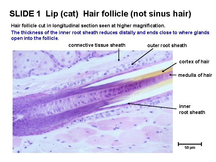 SLIDE 1 Lip (cat) Hair follicle (not sinus hair) Hair follicle cut in longitudinal SLIDE 1 Lip (cat) Hair follicle (not sinus hair) Hair follicle cut in longitudinal