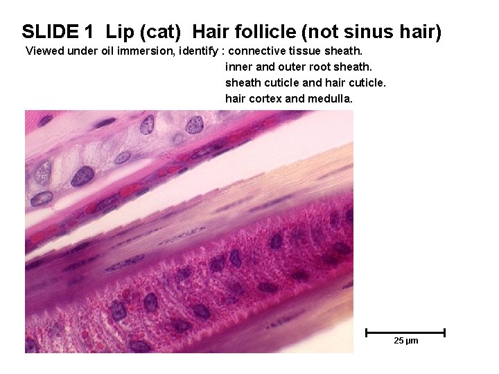 SLIDE 1 Lip (cat) Hair follicle (not sinus hair) Viewed under oil immersion, identify SLIDE 1 Lip (cat) Hair follicle (not sinus hair) Viewed under oil immersion, identify