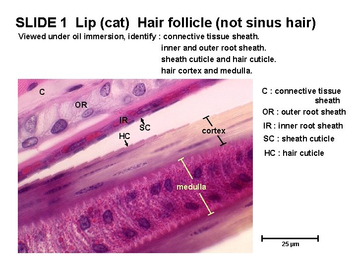 SLIDE 1 Lip (cat) Hair follicle (not sinus hair) Viewed under oil immersion, identify SLIDE 1 Lip (cat) Hair follicle (not sinus hair) Viewed under oil immersion, identify