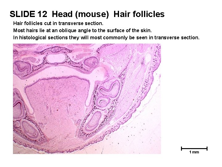 SLIDE 12 Head (mouse) Hair follicles cut in transverse section. Most hairs lie at SLIDE 12 Head (mouse) Hair follicles cut in transverse section. Most hairs lie at