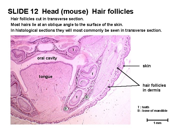 SLIDE 12 Head (mouse) Hair follicles cut in transverse section. Most hairs lie at SLIDE 12 Head (mouse) Hair follicles cut in transverse section. Most hairs lie at