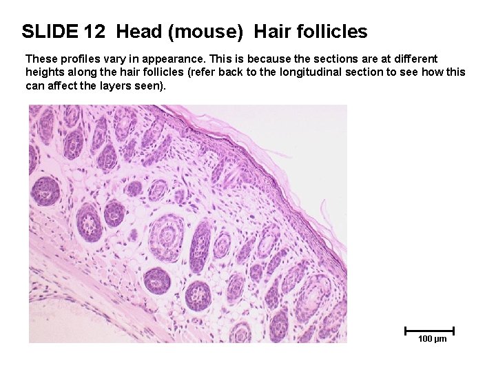 SLIDE 12 Head (mouse) Hair follicles These profiles vary in appearance. This is because SLIDE 12 Head (mouse) Hair follicles These profiles vary in appearance. This is because