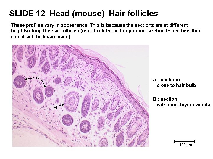 SLIDE 12 Head (mouse) Hair follicles These profiles vary in appearance. This is because SLIDE 12 Head (mouse) Hair follicles These profiles vary in appearance. This is because
