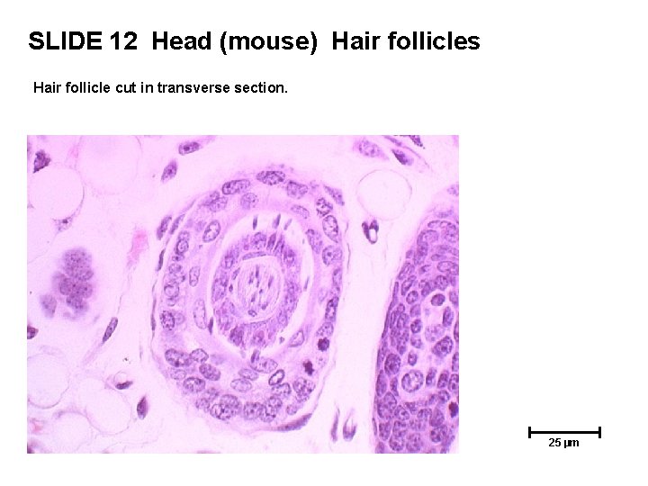 SLIDE 12 Head (mouse) Hair follicles Hair follicle cut in transverse section. 25 µm SLIDE 12 Head (mouse) Hair follicles Hair follicle cut in transverse section. 25 µm