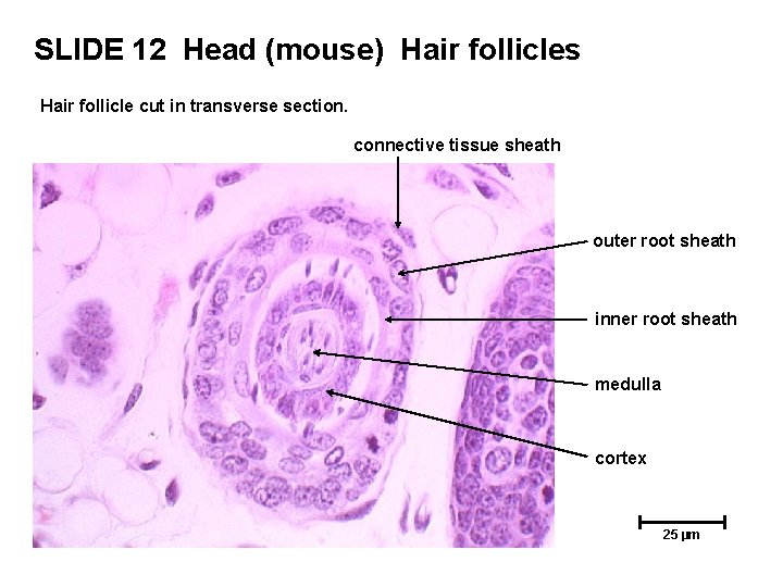 SLIDE 12 Head (mouse) Hair follicles Hair follicle cut in transverse section. connective tissue SLIDE 12 Head (mouse) Hair follicles Hair follicle cut in transverse section. connective tissue