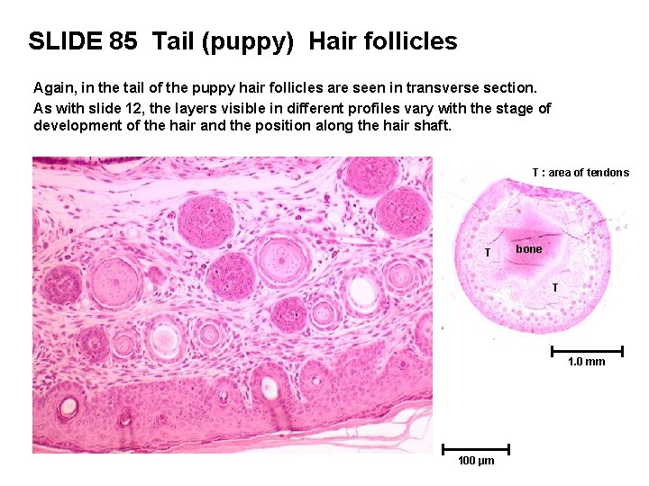 SLIDE 85 Tail (puppy) Hair follicles Again, in the tail of the puppy hair SLIDE 85 Tail (puppy) Hair follicles Again, in the tail of the puppy hair