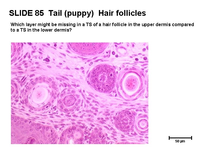 SLIDE 85 Tail (puppy) Hair follicles Which layer might be missing in a TS SLIDE 85 Tail (puppy) Hair follicles Which layer might be missing in a TS