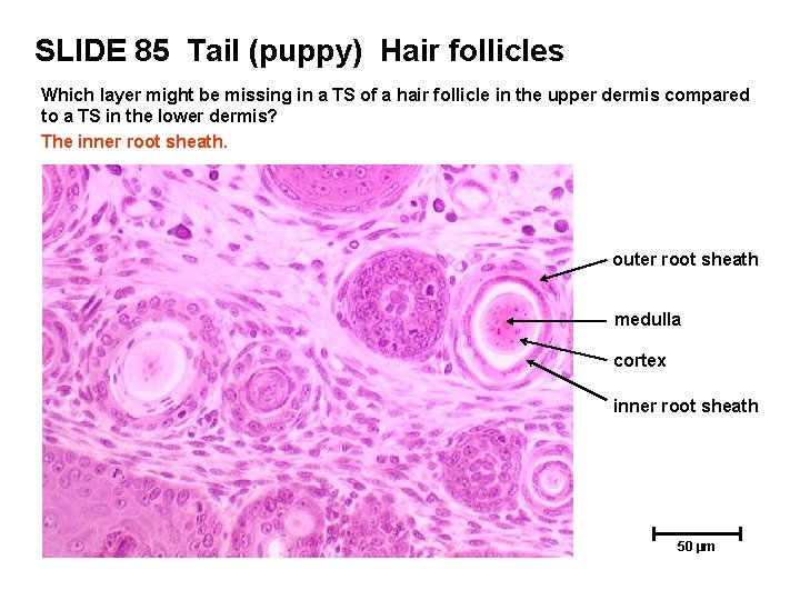 SLIDE 85 Tail (puppy) Hair follicles Which layer might be missing in a TS SLIDE 85 Tail (puppy) Hair follicles Which layer might be missing in a TS
