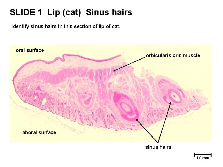 SLIDE 1 Lip (cat) Sinus hairs Identify sinus hairs in this section of lip SLIDE 1 Lip (cat) Sinus hairs Identify sinus hairs in this section of lip