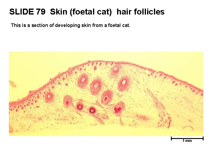SLIDE 79 Skin (foetal cat) hair follicles This is a section of developing skin SLIDE 79 Skin (foetal cat) hair follicles This is a section of developing skin