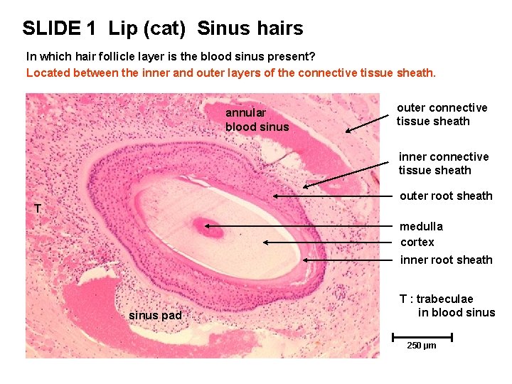 SLIDE 1 Lip (cat) Sinus hairs In which hair follicle layer is the blood SLIDE 1 Lip (cat) Sinus hairs In which hair follicle layer is the blood