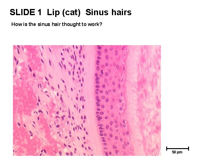 SLIDE 1 Lip (cat) Sinus hairs How is the sinus hair thought to work? SLIDE 1 Lip (cat) Sinus hairs How is the sinus hair thought to work?