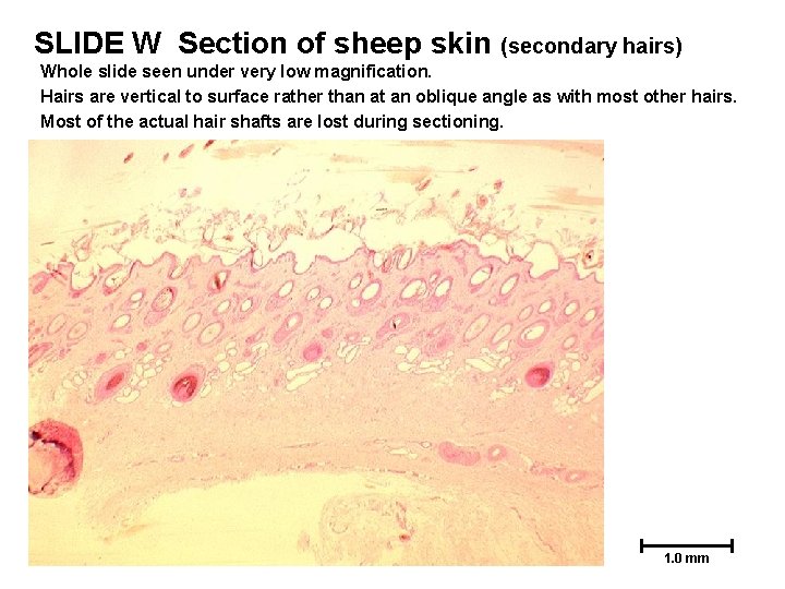 SLIDE W Section of sheep skin (secondary hairs) Whole slide seen under very low SLIDE W Section of sheep skin (secondary hairs) Whole slide seen under very low