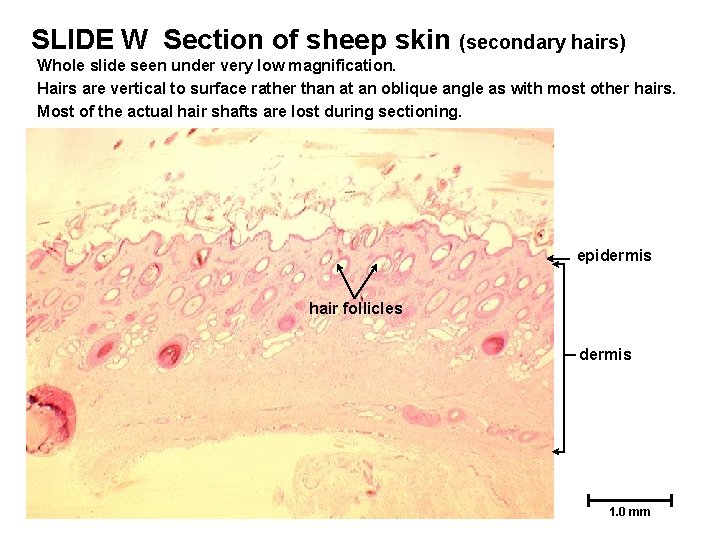 SLIDE W Section of sheep skin (secondary hairs) Whole slide seen under very low SLIDE W Section of sheep skin (secondary hairs) Whole slide seen under very low