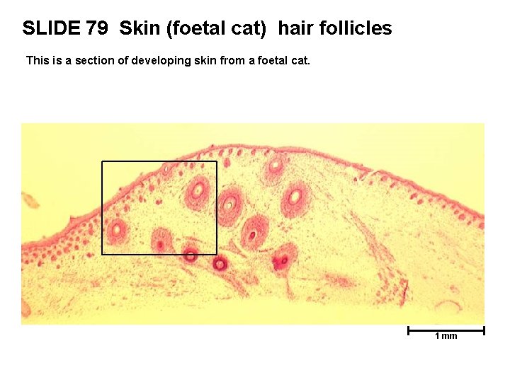 SLIDE 79 Skin (foetal cat) hair follicles This is a section of developing skin SLIDE 79 Skin (foetal cat) hair follicles This is a section of developing skin