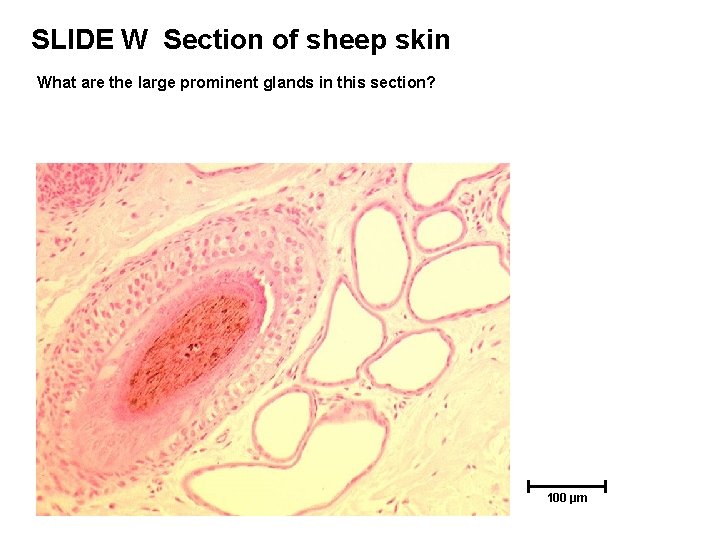 SLIDE W Section of sheep skin What are the large prominent glands in this SLIDE W Section of sheep skin What are the large prominent glands in this