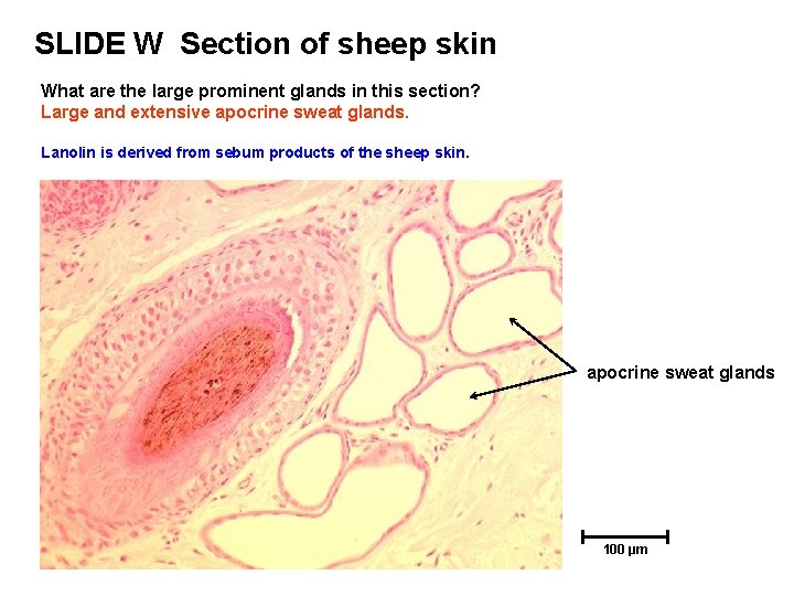 SLIDE W Section of sheep skin What are the large prominent glands in this SLIDE W Section of sheep skin What are the large prominent glands in this