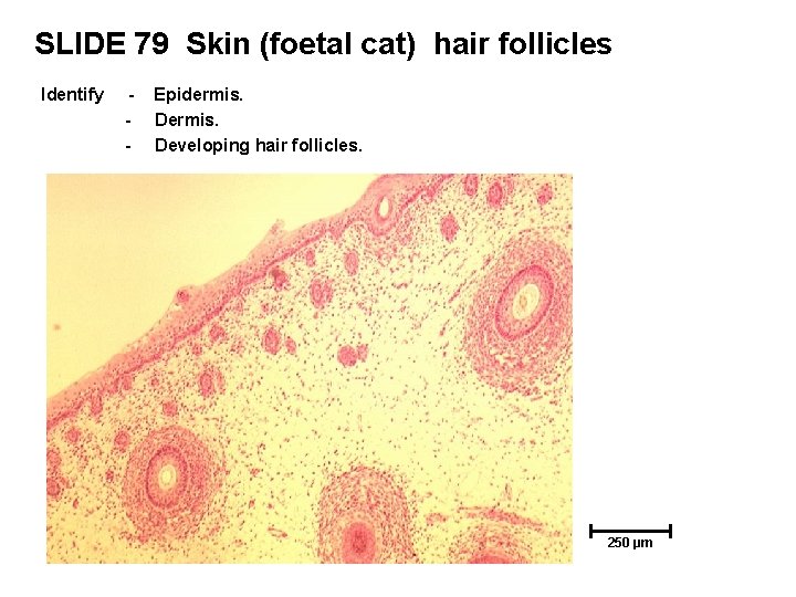 SLIDE 79 Skin (foetal cat) hair follicles Identify - Epidermis. Developing hair follicles. 250 SLIDE 79 Skin (foetal cat) hair follicles Identify - Epidermis. Developing hair follicles. 250