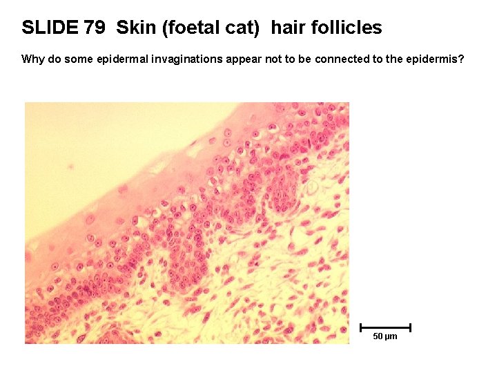 SLIDE 79 Skin (foetal cat) hair follicles Why do some epidermal invaginations appear not SLIDE 79 Skin (foetal cat) hair follicles Why do some epidermal invaginations appear not
