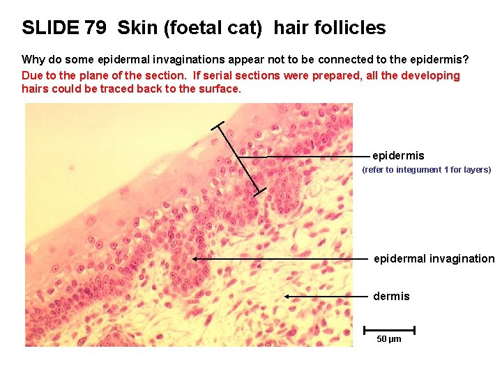 SLIDE 79 Skin (foetal cat) hair follicles Why do some epidermal invaginations appear not SLIDE 79 Skin (foetal cat) hair follicles Why do some epidermal invaginations appear not