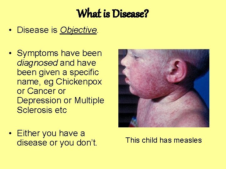 What is Disease? • Disease is Objective. • Symptoms have been diagnosed and have