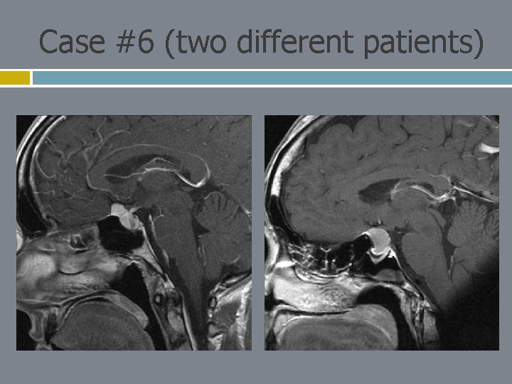 Case #6 (two different patients) 