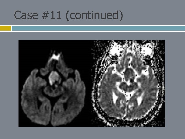 Case #11 (continued) 