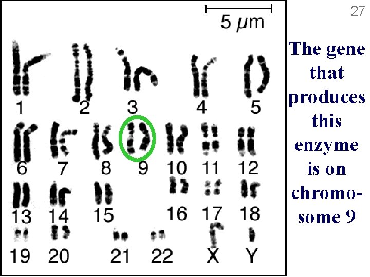 27 The gene that produces this enzyme is on chromosome 9 