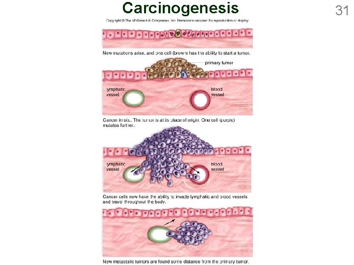 Carcinogenesis 31 