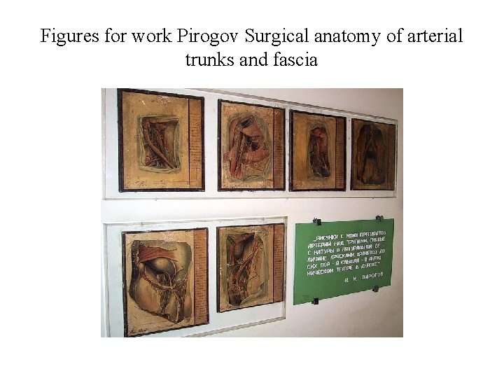 Figures for work Pirogov Surgical anatomy of arterial trunks and fascia Figures for work Pirogov Surgical anatomy of arterial trunks and fascia